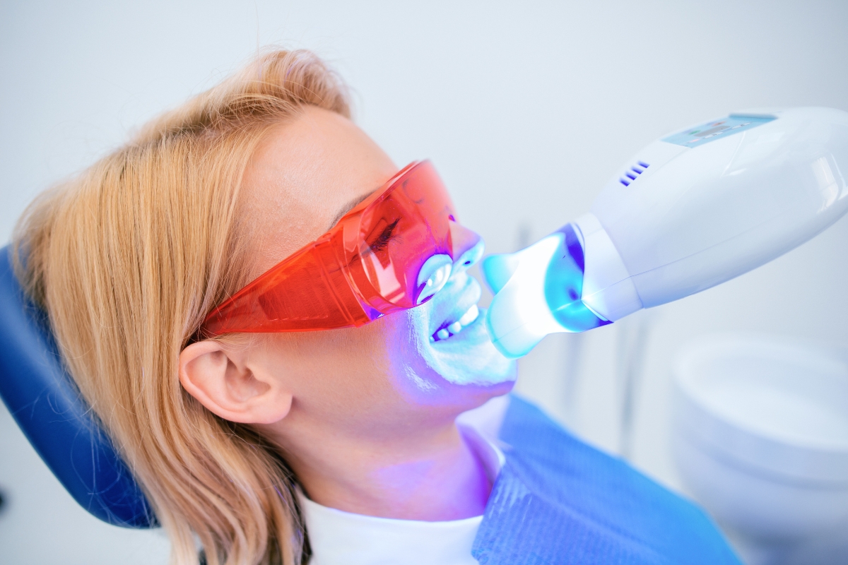 teeth-whitening-in-Pasadena