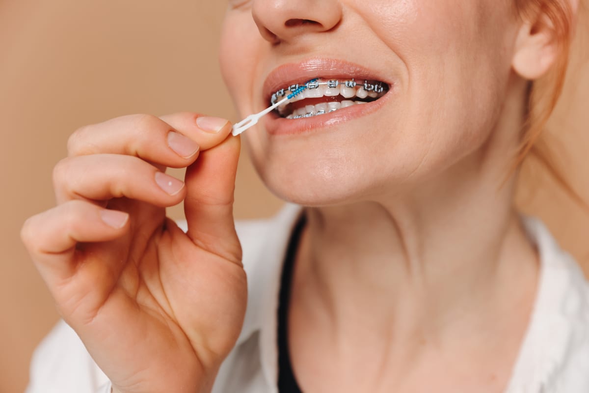 Orthodontics in Pasadena